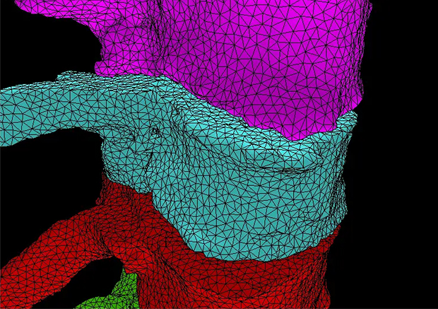 AI for Radiology thumbnail